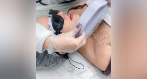 Fotorrejuvenescimento é bom mesmo? Vale a pena fazer?