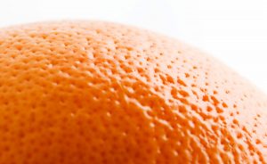 Poros dilatados: 4 hábitos que dilatam seus poros