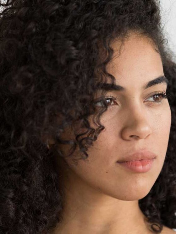 Espinhas no couro cabeludo? 5 dicas para acabar com a inflamação