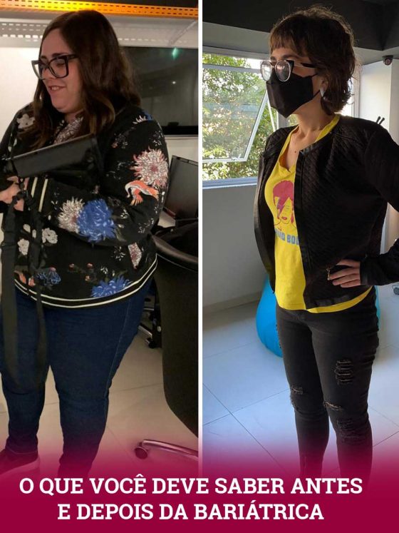 Cirurgia Bariátrica: o que você precisa saber antes e depois da Redução de Estômago?