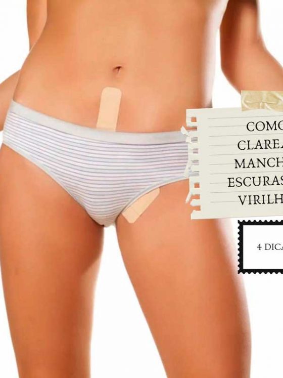 Manchas escuras na virilha? 4 dicas para clarear a área!