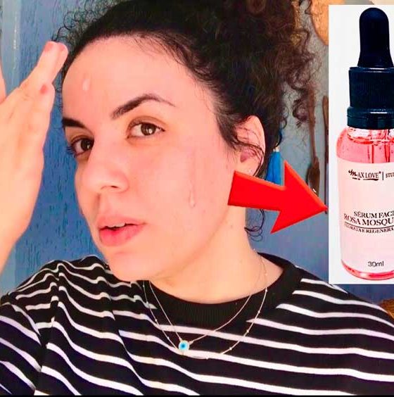 Resenha Sérum Facial Rosa Mosqueta Max Love com Ácido Hialurônico e colágeno Hidrolisado.