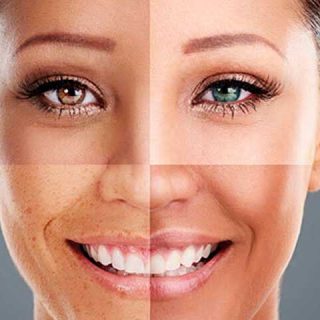 Serum facial 99% Babosa (Aloe Vera) da Shein e Shopee! – Baratinho Aichun Beauty