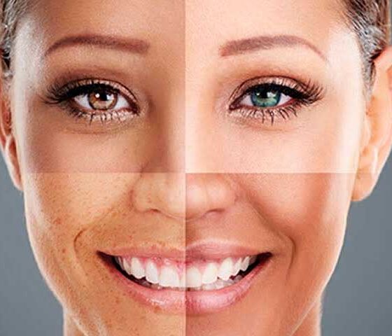 Como saber seu tipo de pele do rosto? 4 tipos: Normal, Mista, Seca ou Oleosa?