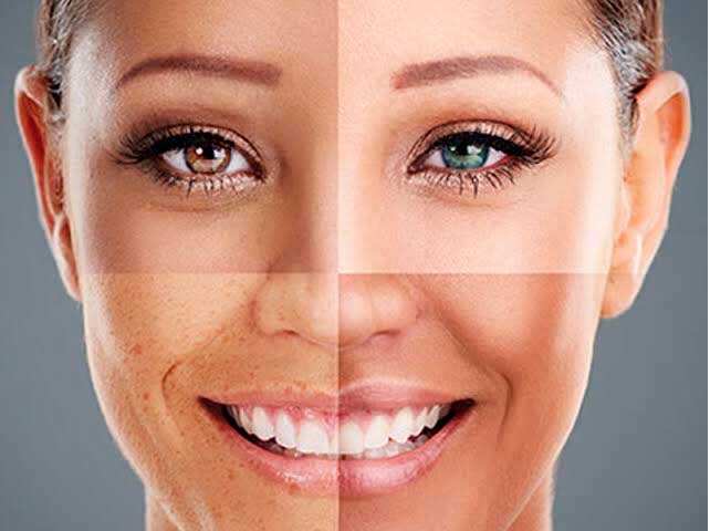Como saber seu tipo de pele do rosto