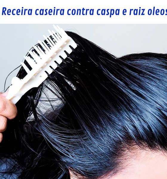 Receita caseira contra caspa e oleosidade no couro cabeludo: acabe com a raiz oleosa!