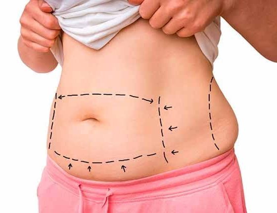 Cirurgia plástica: 5 motivos para NÃO fazer