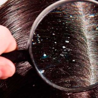 Como desembaraçar o cabelo rapidamente: 2 dicas