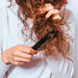 Como acabar com a caspa rapidamente? 3 dicas caseiras