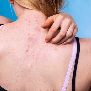 Como eu salvaria o cabelo da Jade Picon em 3 passos: cabelo pós química e ressecado