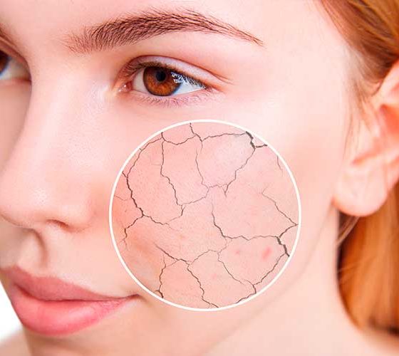 Como fazer a base não craquelar e não transferir? 3 dicas básicas!