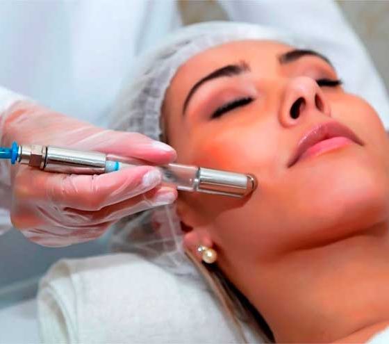 Peeling de diamante: funciona mesmo? Para o que serve e quanto custa?